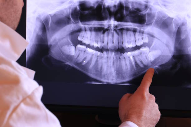 Best Emergency Dental Extractions in Lake Hamilton, AR
